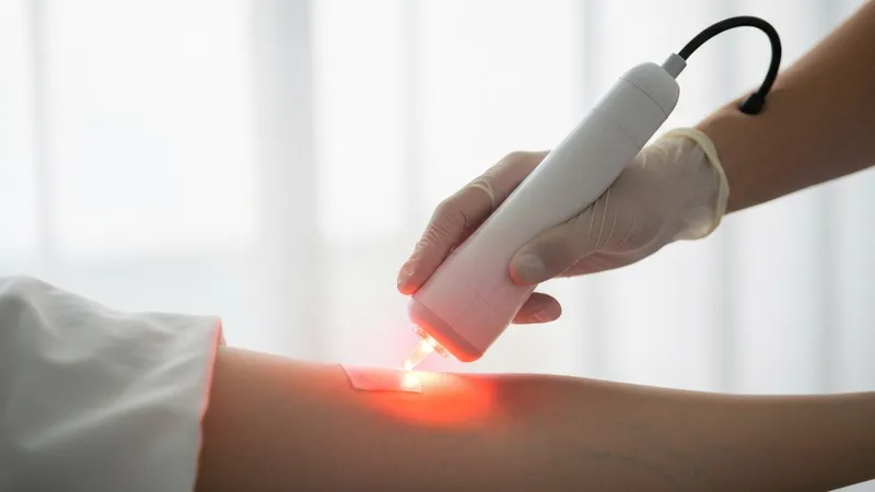 Fotobiomodulación para cicatrización: acelera tu recuperación
